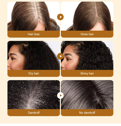 Lewedo Naturals Batana Oil Fast Hair Growth for Men Women