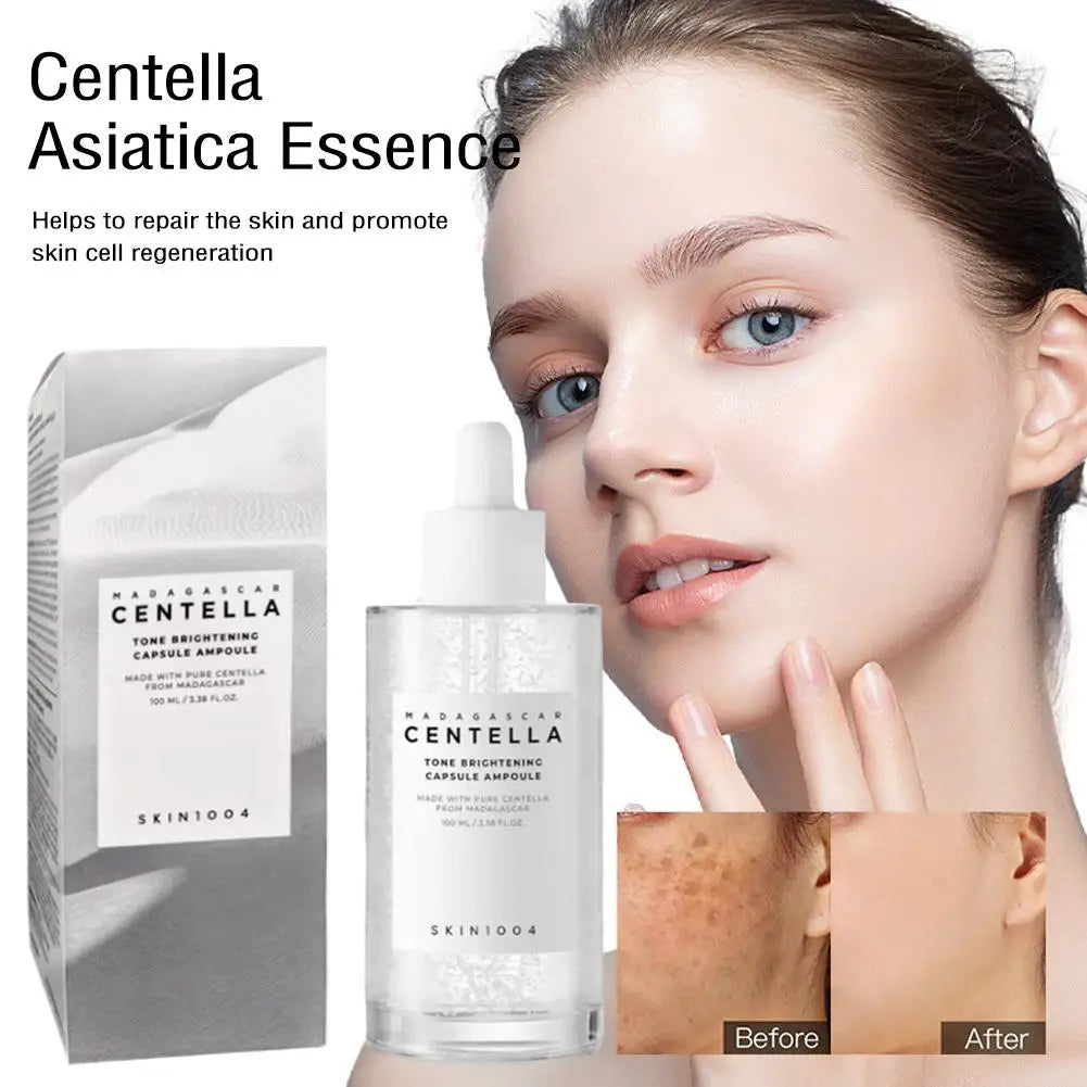 Madagascar Centella Asiatica Ampoule Facial Serum Moisturizer